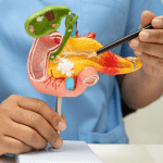 Pancreatic Cancer Awareness Month