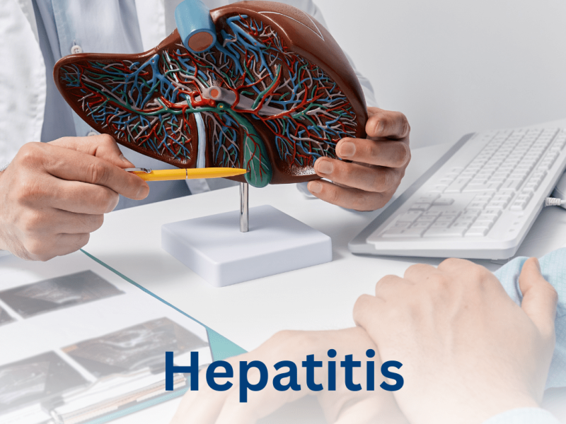 Hepatitis Elimination