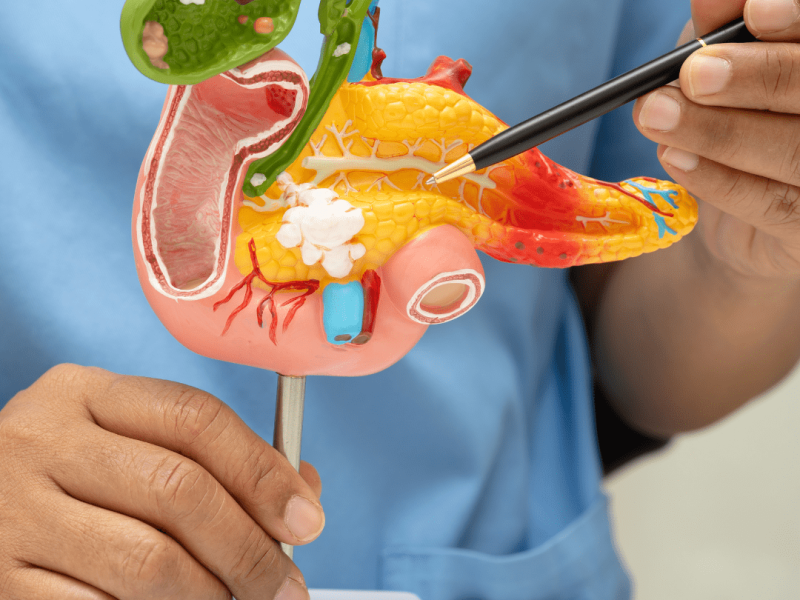 Pancreatic Cancer Awareness Month